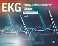 EKG pułapki, które niełatwo ominąć Przypadki kliniczne Tom 1 - Szafran Bartosz - książka