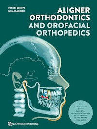 Aligner Orthodontics and Orofacial Orthopedics - Werner Schupp - ebook