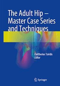 The Adult Hip - Master Case Series and Techniques -  - ebook