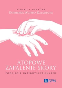 Atopowe zapalenie skóry Podejście interdyscyplinarne - Wcisło-Dziadecka Dominika - książka