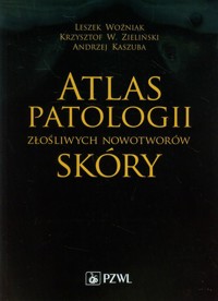 Atlas patologii złośliwych nowotworów skóry - Woźniak Leszek, Zieliński Krzysztof W., Kaszuba Andrzej - książka
