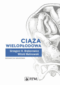 Ciąża wielopłodowa - Grzegorz H Bręborowicz, Witold Malinowski - książka