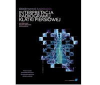 Odkrywanie radiologii interpretacja radiogramu klatki piersiowej - Dobranowski Julian, Dobranowski Alexander J., Levinson Anthony J. - książka