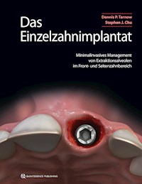 Das Einzelzahnimplantat - Dennis P. Tarnow - ebook