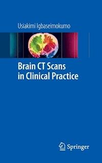 Brain CT Scans in Clinical Practice - Usiakimi Igbaseimokumo - ebook