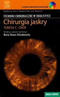 Chirurgia jaskry z płytą CD -  - książka
