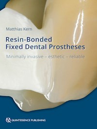 Resin-Bonded Fixed Dental Prostheses - Matthias Kern - ebook