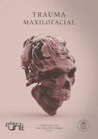 Trauma maxilofacial -  - ebook