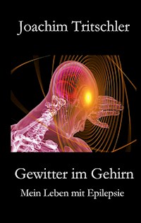 Gewitter im Gehirn - Joachim Tritschler - ebook