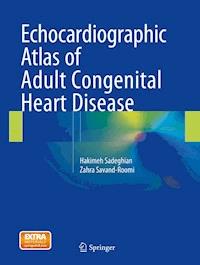 Echocardiographic Atlas of Adult Congenital Heart Disease - Hakimeh Sadeghian - ebook