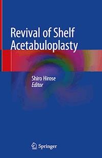 Revival of Shelf Acetabuloplasty -  - ebook