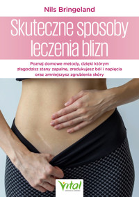 Skuteczne sposoby leczenia blizn - Nils Bringeland - ebook