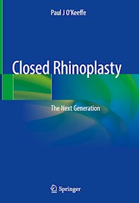 Closed Rhinoplasty - Paul J O'Keeffe - ebook