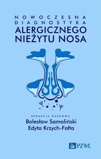 Nowoczesna diagnostyka alergicznego nieżytu nosa - Edyta Krzych-Fałta, Bolesław Samoliński - książka