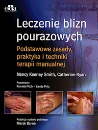 Leczenie blizn pourazowych - Keeney Smith Nancy, Ryan Cathy - książka