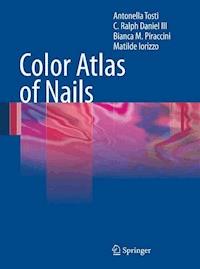 Color Atlas of Nails - Antonella Tosti - ebook