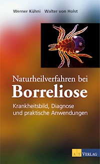 Naturheilverfahren bei Borreliose - eBook - Kuhni Werner - ebook