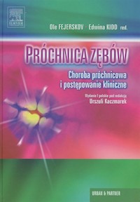 Próchnica zębów -  - książka