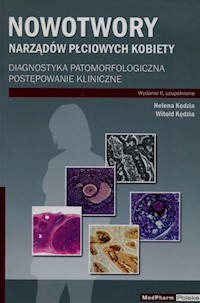 Nowotwory narządów płciowych kobiety - Kędzia Helena, Kędzia Witold - książka