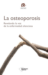 La osteoporosis - Autores varios - ebook