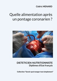 Quelle alimentation après un pontage coronarien ? - Menard Cédric - ebook