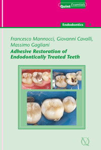 Adhesive Restoration of Endodontically Treated Teeth - Francesco Mannocci - ebook