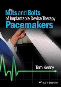 The Nuts and Bolts of Implantable Device Therapy - Tom Kenny - ebook