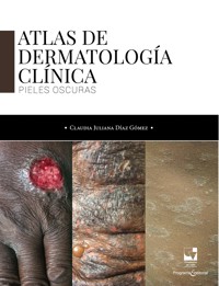 Atlas de dermatología clínica - Claudia Juliana Díaz Gómez - ebook