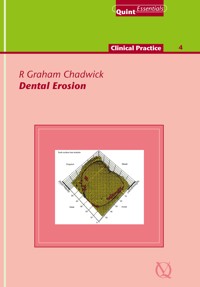 Dental Erosion - R. Graham Chadwick - ebook