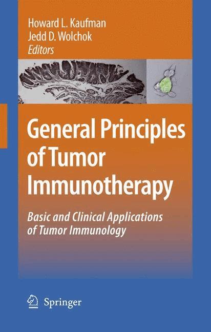General Principles of Tumor Immunotherapy