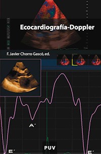 Ecocardiografía-Doppler - Varios autores - ebook