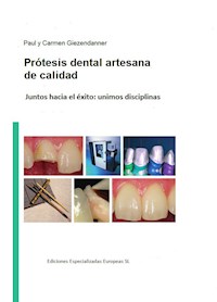 Prótesis dental artesanal de calidad - Paul Giezendanner - ebook