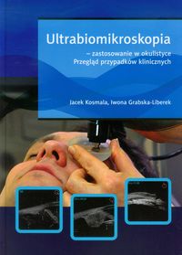 Ultrabiomikroskopia - zastosowanie w okulistyce - Kosmala Jacek, Grabska-Liberek Iwona - książka