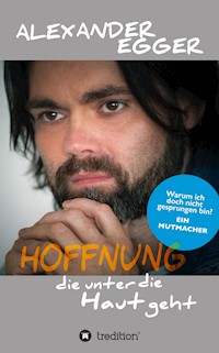 Hoffnung die unter die Haut geht - Alexander Egger - ebook