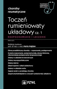 Toczeń rumieniowaty układowy Część 1 Rozpoznawanie i leczenie - Majdan Maria - książka