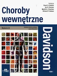 Davidson Choroby wewnętrzne Tom 1 -  - książka