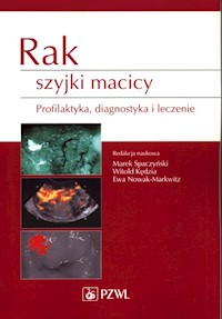 Rak szyjki macicy -  - książka