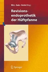 Revisionsendoprothetik der Hüftpfanne -  - ebook