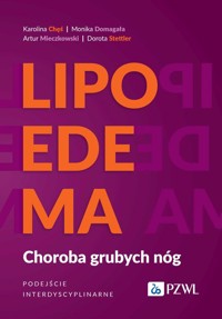Lipoedema - Chęś Karolina, Domagała Monika, Mieczkowski Artur, Stettler Dorota - książka