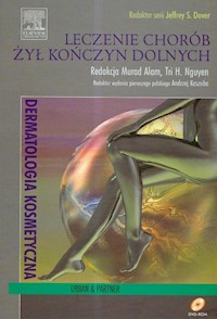 Leczenie chorób żył kończyn dolnych z płytą DVD -  - książka