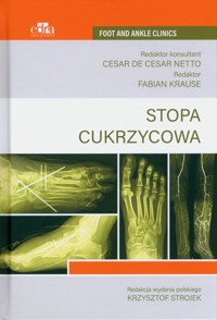 Stopa cukrzycowa -  - książka
