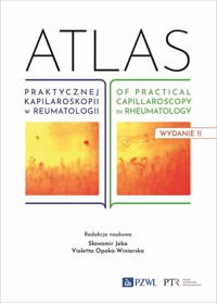 Atlas praktycznej kapilaroskopii w reumatologii. Atlas of practical capillaroscopy in rheumatology - Sławomir Jeka, Violetta Opoka-Winiarska - książka