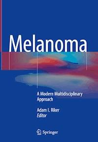 Melanoma -  - ebook