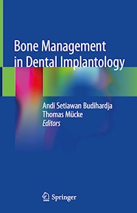 Bone Management in Dental Implantology -  - ebook