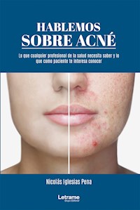 Hablemos sobre acné: 01 (Manual) - Nicolás Iglesias Pena - ebook