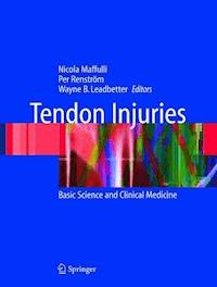 Tendon Injuries -  - ebook