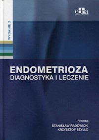Endometrioza Diagnostyka i leczenie -  - książka