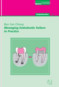 Managing Endodontic Failure in Practice - Bun San Chong - ebook