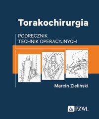 Torakochirurgia - Marcin Zieliński - książka