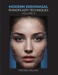 Modern Endonasal Rhinoplasty Techniques – Volume 2 - Pietro Palma - ebook